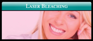 Laser Bleaching